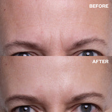 Load image into Gallery viewer, Wrinkles Schminkles Forehead Patches (Single)