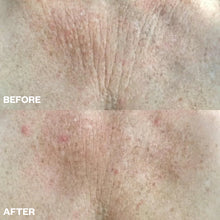 Load image into Gallery viewer, Chest Wrinkle Patch