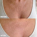 Load image into Gallery viewer, Chest Wrinkle Patch