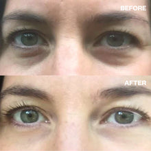 Load image into Gallery viewer, Eye Wrinkle Patches (3 Pack)