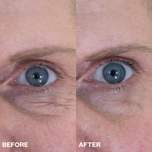 Load image into Gallery viewer, Eye Wrinkle Patches (3 Pack)