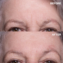 Load image into Gallery viewer, Forehead Wrinkle Patches (2 Pack)